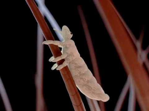 Head louse, artwork Illustrazione stock