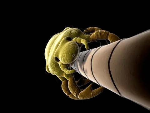 Head louse, artwork Stock Illustration