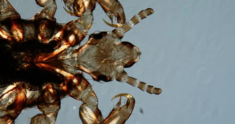 Head louse 스톡 동영상 144874524