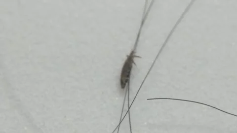 Head Louse Stock Footage 315080048