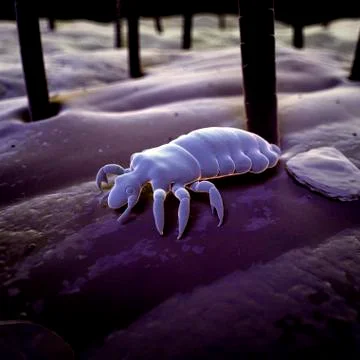 Head louse, illustration Stock Illustration