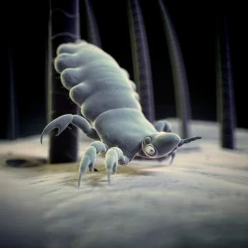 Head louse, illustration Stock Illustration