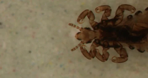 Head louse with legs Stock Footage 154263916