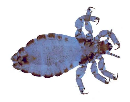 Head louse, light micrograph Stock Photos