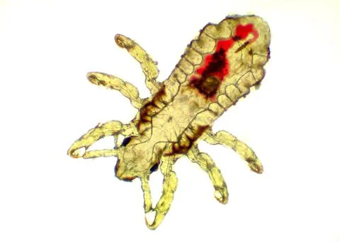 Head Louse - Pediculus capitis, microscope picture, blood inside its body Stock Photos