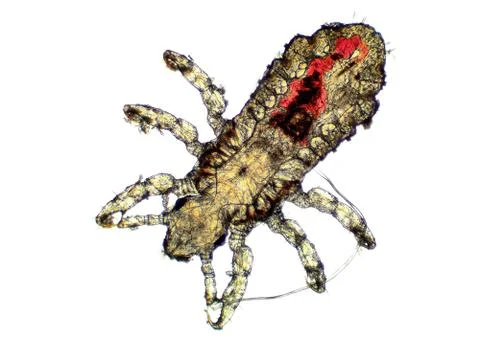 Head Louse - Pediculus capitis, microscope picture, blood inside its body Foto stock