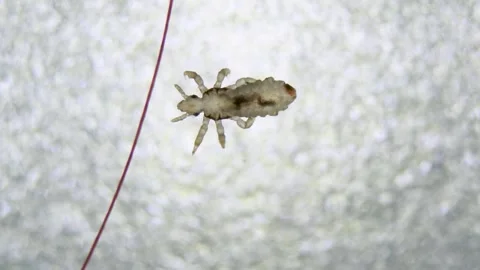 Head louse walking on white bumpy surface bellow human hair. Extreme closeup Video stock 248177583