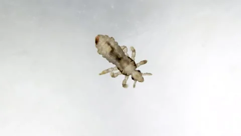 Head louse walking on white slippery smooth surface. Extreme closeup detail of Stock Footage 248177649