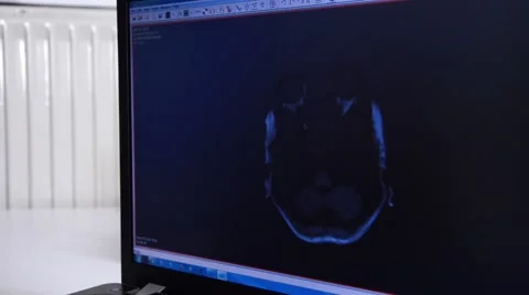 Head MRI of a 34 years old woman Stock Footage 43965381