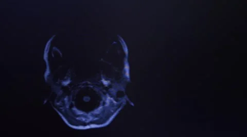 Head MRI of a 34 years old woman Stock Footage 43965570