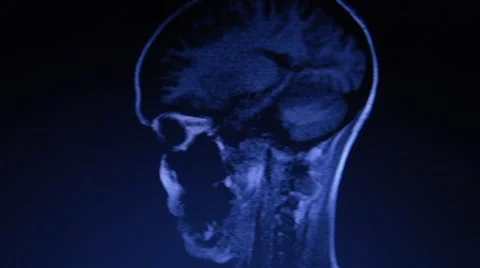 Head MRI Stock Footage 43910016