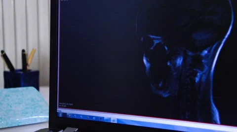 Head MRI Stock Footage 43956277