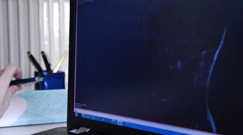 Head MRI Stock Footage 43958434