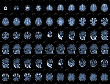 Head mri Stock Photos