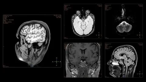 Head MRI scan from different angles Stock Illustration