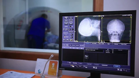 Head MRI scan doctor Vídeo Stock 36620976