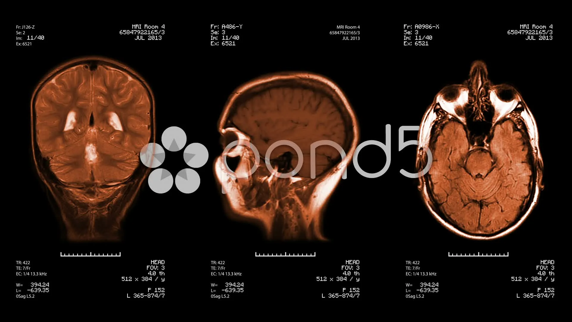 Mri Images Of A Patient S Head Background Wallpaper Image For Free Download  - Pngtree