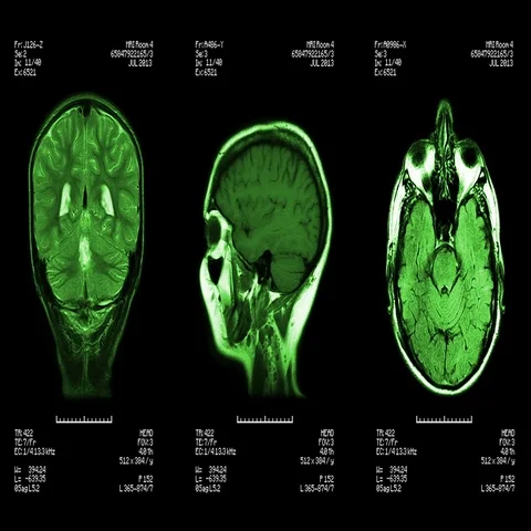 Head MRI scan. Loopable. Stock-Footage 69601355