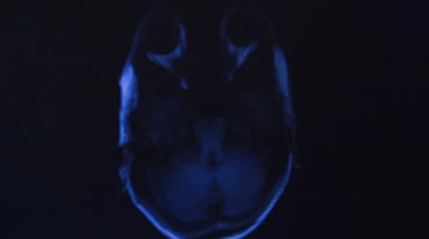 Head MRI slide show on a computer Stock Footage 43965259