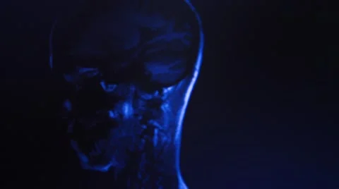 Head MRI slide show on a computer Stock Footage 43965724