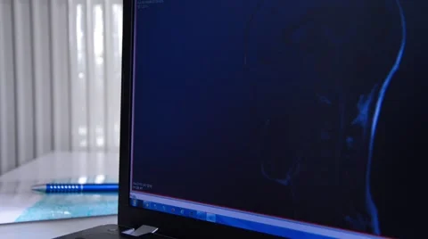 Head MRI slide show on a computer Stock Footage 43966026