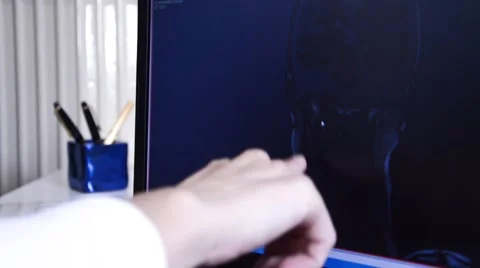 Head MRI slide show on a computer Video stock 43966354