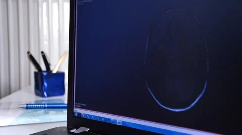 Head MRI slide show on a computer Stock Footage 43966429