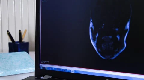 Head MRI slide show on a computer Stock Footage 43966445