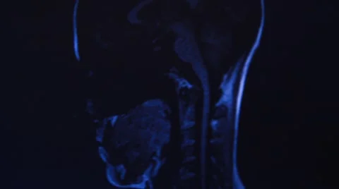 Head MRI slide show Stock Footage 43965053