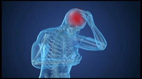 Head pain Attack, man suffering from brain pain. 3D animation Stock Footage 89565676