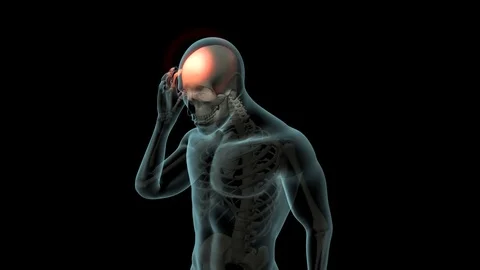 Head Pain 스톡 동영상 121787886