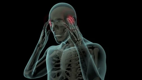 Head Pain Version 2 스톡 동영상 124810290