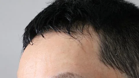 The head of a person who is sweating Stock Photos