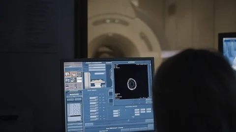 Head Scanning In the Modern Brain Study Laboratory. Screens with Brain activity Stock Footage 102224091