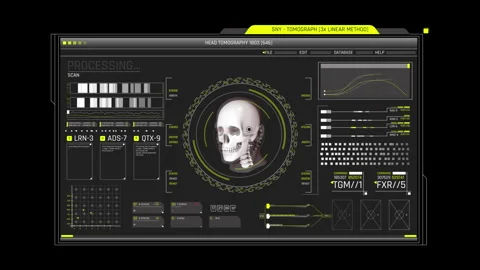 Head Tomography Skull Scan HUD Medical Sci-Fi UI Interface Video stock 338390215