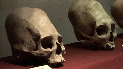 Head Trempanation, Historic Operation, Peru, South America Stock Footage 48731663