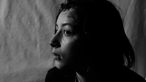 Head wound daze Stock Footage 78691742