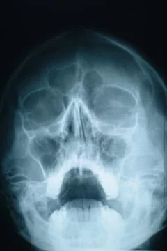 Head xray Stock Photos