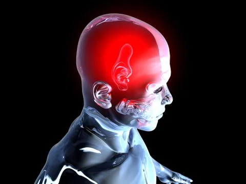 Headache - anatomy イラスト素材