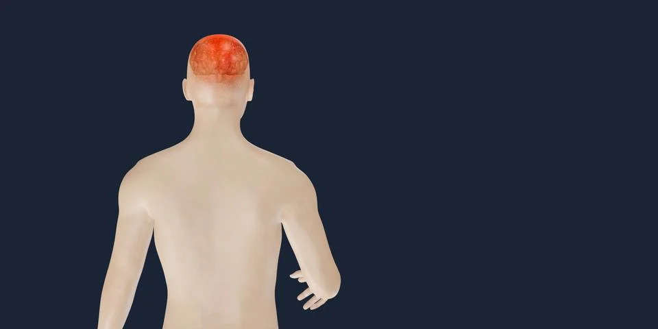 Headache brain system problems skull pain face man showing headaches 3d Illustrazione stock