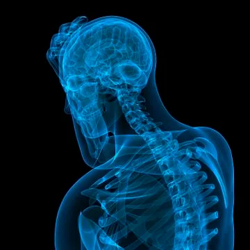 Headache, conceptual artwork Stock Illustration