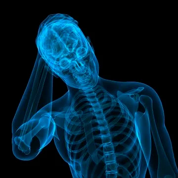 Headache, conceptual artwork Stock Illustration