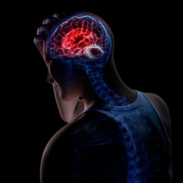 Headache, conceptual artwork Stock Illustration