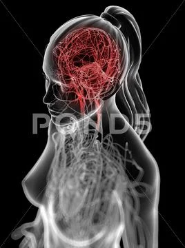 Headache, conceptual artwork Stock Illustration