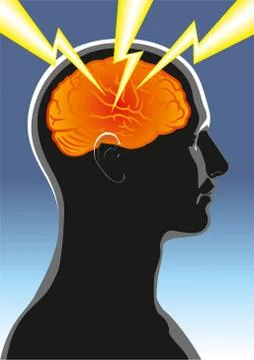 Headache Stock Illustration