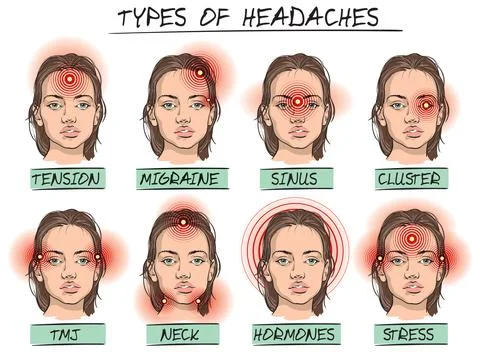 Headache types Stock Illustration