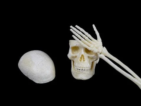 HeadachesHuman skull without the top of the head put a skeleton hand on the h Stock Photos