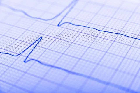 Health care background of Electrocardiogram plot Fotos de archivo