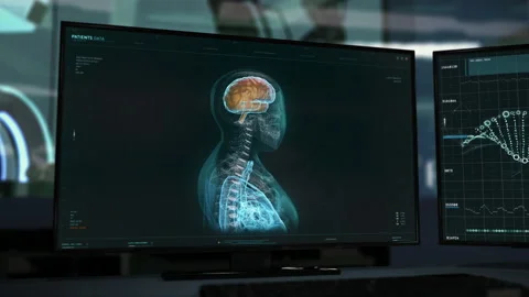 Health Diagnostic Interface Technology On Screen In Epidemic Research Laboratory Stock Footage 171070583