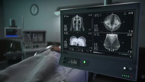 Cancer Screening Stock Video Footage